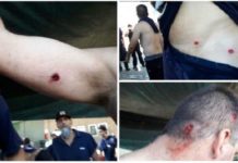 Brutal represión a empleados de AGR-Clarín con balas de goma en la puerta de la imprenta