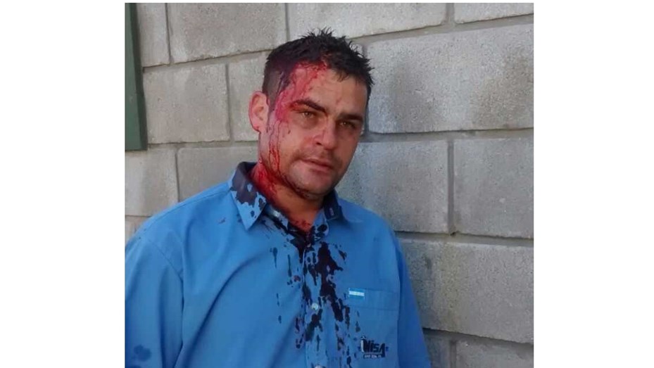 Otro colectivero herido en un violento asalto en La Matanza