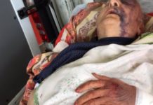 Atacan ferozmente a un jubilado de 92 años para robarle en el partido Merlo Atacan ferozmente a un jubilado de 92 años en Merlo
