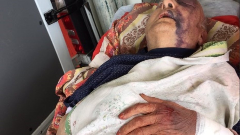 Atacan ferozmente a un jubilado de 92 años en Merlo