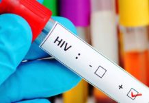 Gravísimo, el gobierno frenó la entrega de remedios para pacientes con VIH hiv, sida, gobierno freno medicamentos