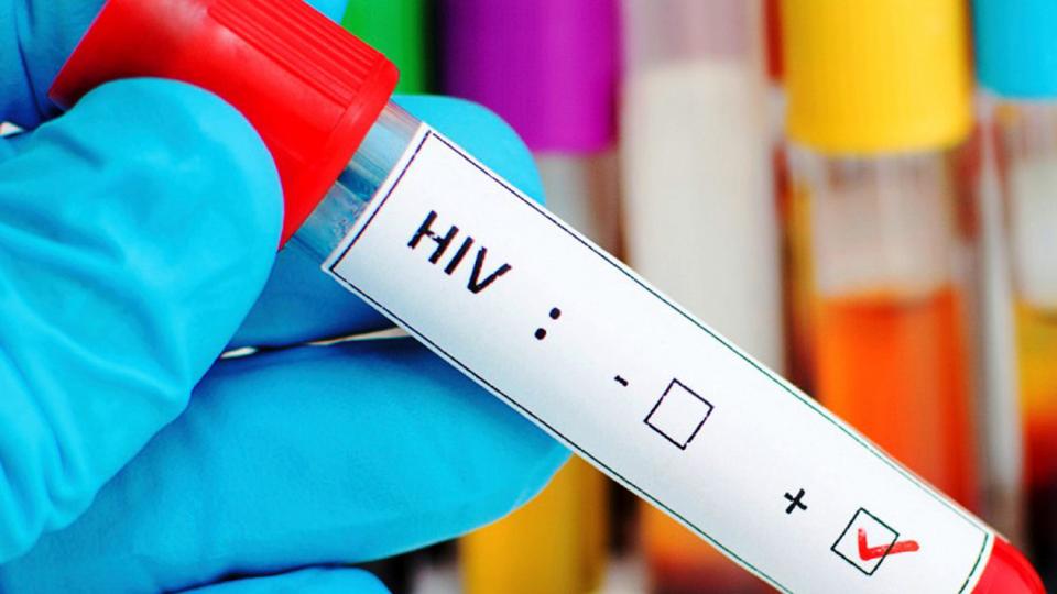 hiv, sida, gobierno freno medicamentos