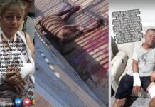Pitbull de funcionario municipal atacó a seis vecinos y lo mataron