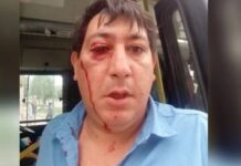Golpearon a un chofer en Mar del Plata por hacer respetar el protocolo covid-19 chofer, mar del plata, golpeado, golpes,