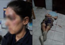 Un policía le disparó a un joven en una comisaría de Almirante Brown Don Orione, comisaría 8