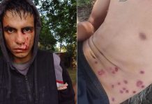 Violencia policial sin frenos: 11 jóvenes fueron heridos con balas de goma en Escobar